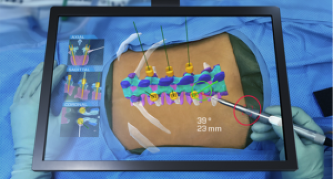 Augmented Reality Transforms Spinal Surgery
