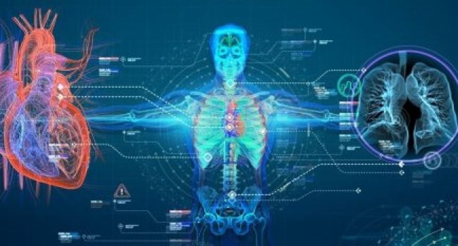 AI is transforming Radiology